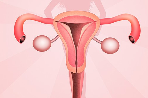 全面了解附件炎