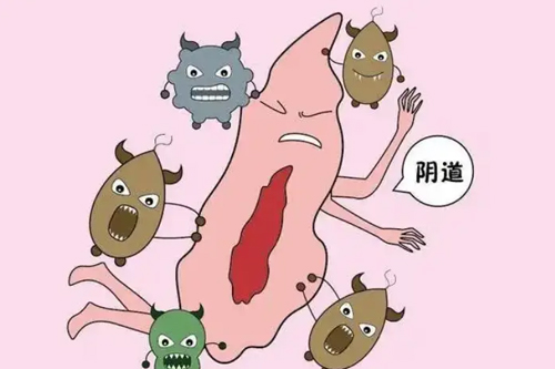 什么是阴道炎